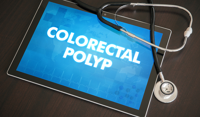 Optimizing Colorectal Cancer and Polyp Surveillance after Colorectal Polypectomy 
