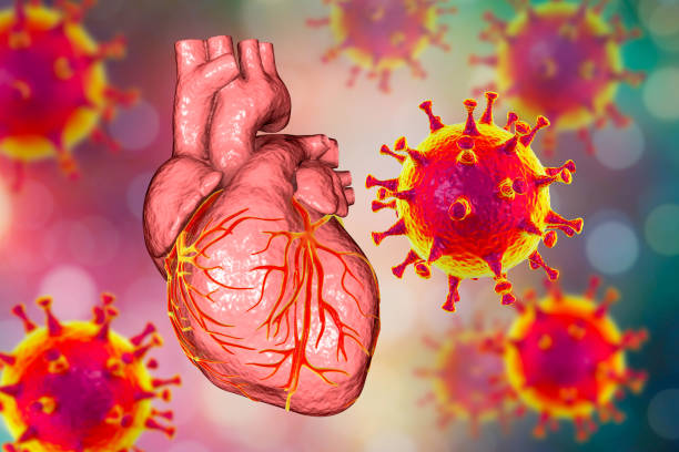 Increased Risk for Cardiovascular Conditions Following COVID-19 Infection